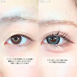 アリエル美容クリニック 横浜院 渡邉 光医師の症例