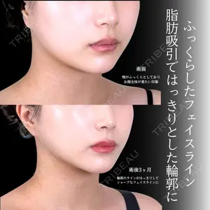 アリエル美容クリニック 横浜院 渡邉 光医師の症例