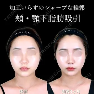 アリエル美容クリニック 横浜院 渡邉 光医師の症例