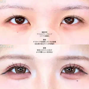 アリエル美容クリニック 横浜院 渡邉 光医師の症例