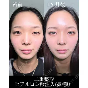 HAAB×DREAM BEAUTY CLINIC 大阪梅田院 柏木 太雅医師の症例