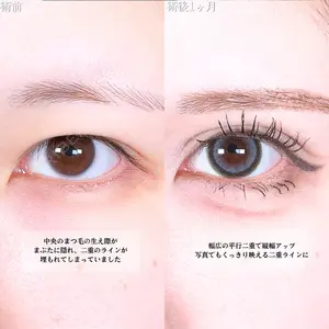 アリエル美容クリニック 大宮院 鈴木　桂介医師の症例