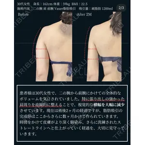MYCLI【マイクリ】大阪・梅田院 三木 晶森医師の症例