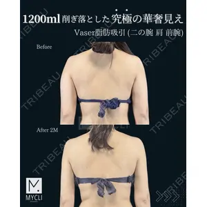 MYCLI【マイクリ】大阪・梅田院 三木 晶森医師の症例