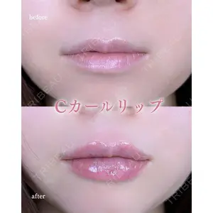 ルラ美容クリニック 町田院 松岡 舟作医師の症例