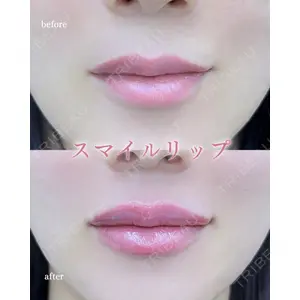 ルラ美容クリニック 町田院 松岡 舟作医師の症例