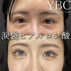 YBC横浜美容外科 立川院 大島 諒士医師の症例