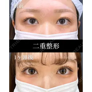 HAAB×DREAM BEAUTY CLINIC 東京本院 田中 優太医師の症例