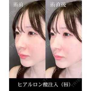 HAAB CLINIC 福岡院 北村 可恋医師の症例