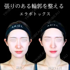 アリエル美容クリニック 大宮院 江郷隼一郎医師の症例