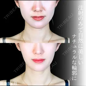 アリエル美容クリニック 大宮院 江郷隼一郎医師の症例