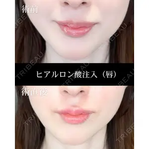 HAAB CLINIC 福岡院 北村 可恋医師の症例