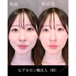 HAAB CLINIC 福岡院 北村 可恋医師の症例