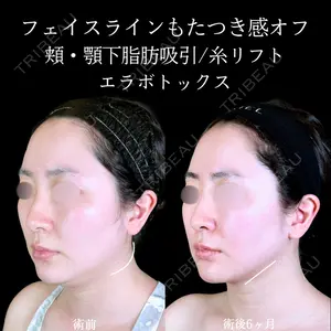 アリエル美容クリニック 郡山院 安齋 誠基医師の症例