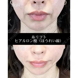 HAAB CLINIC 福岡院 北村 可恋医師の症例