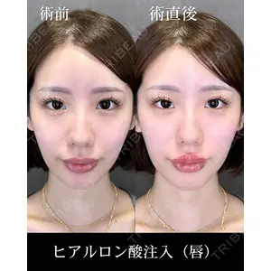 HAAB CLINIC 福岡院 北村 可恋医師の症例