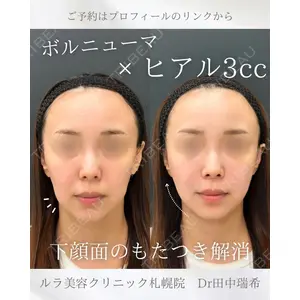 ルラ美容クリニック 札幌本院 田中 瑞希医師の症例