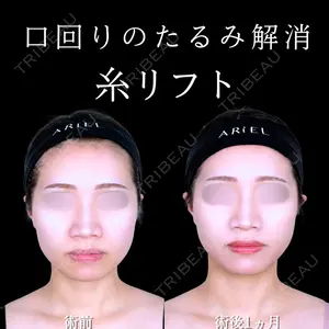 アリエル美容クリニック 大宮院の症例