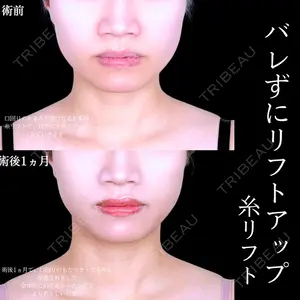 アリエル美容クリニック 大宮院の症例