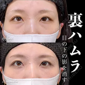 EMMO FACE CLINIC 大宮院 百瀬 直也医師の症例