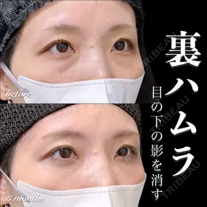 EMMO FACE CLINIC 大宮院 百瀬 直也医師の症例