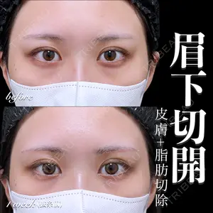 EMMO FACE CLINIC 大宮院 百瀬 直也医師の症例