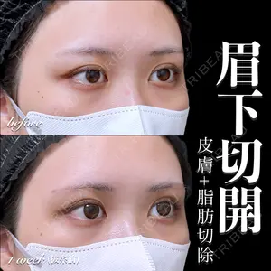 EMMO FACE CLINIC 大宮院 百瀬 直也医師の症例