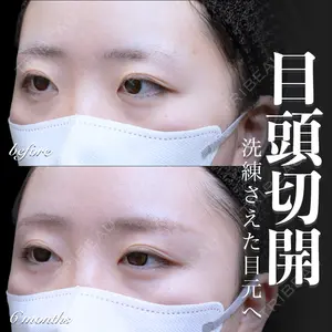 EMMO FACE CLINIC 大宮院 百瀬 直也医師の症例
