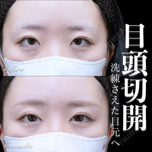 EMMO FACE CLINIC 大宮院 百瀬 直也医師の症例