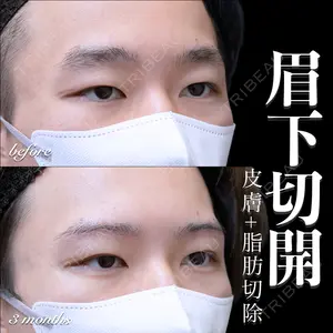 EMMO FACE CLINIC 大宮院 百瀬 直也医師の症例