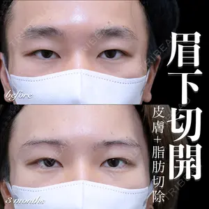 EMMO FACE CLINIC 大宮院 百瀬 直也医師の症例