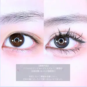 アリエル美容クリニック 郡山院 安齋 誠基医師の症例
