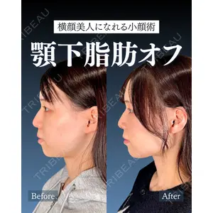 神戸美容外科 ネビュラクリニック 岩﨑 雅医師の症例