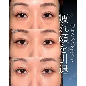 神戸美容外科 ネビュラクリニック 岩﨑 雅医師の症例