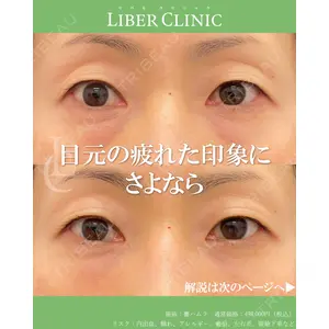 LIBER CLINIC 矢橋 洋一郎医師の症例