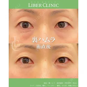 LIBER CLINIC 矢橋 洋一郎医師の症例