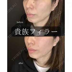 ルラ美容クリニック 大阪心斎橋院の症例
