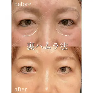 アデル美容クリニックの症例