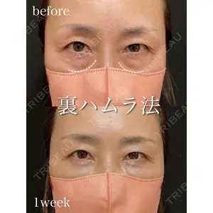 アデル美容クリニックの症例