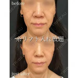 アデル美容クリニックの症例