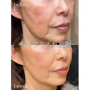 アデル美容クリニックの症例