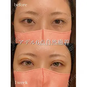 アデル美容クリニックの症例