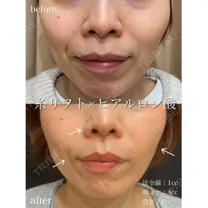 アデル美容クリニック 青柳 慶憲医師の症例
