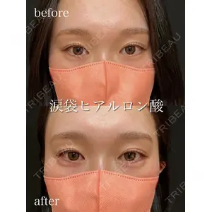アデル美容クリニックの症例