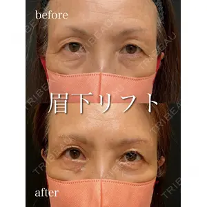 アデル美容クリニックの症例