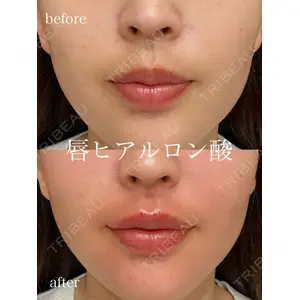 アデル美容クリニックの症例