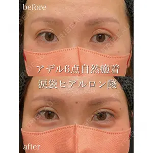 アデル美容クリニックの症例