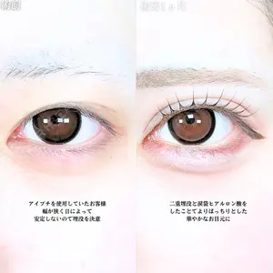 アリエル美容クリニック 大宮院 江郷隼一郎医師の症例