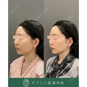 オアシス美容外科 遠藤 剛史医師の症例