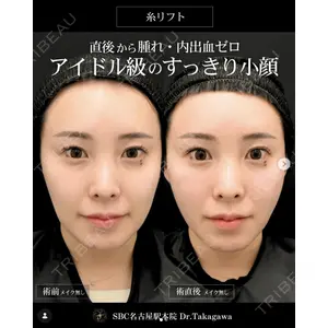 湘南美容クリニック 名古屋駅本院 高川 裕也医師の症例